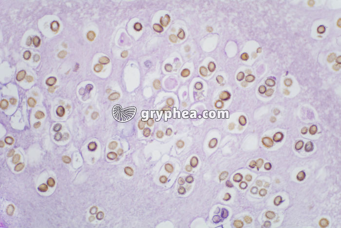 Truffe (Tuber melanosporum) montrant les ascospores CT x25 - gryphea.com